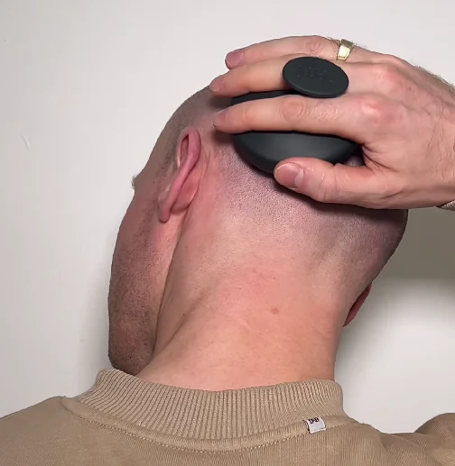 Remi - Scalp Massager - Image 5